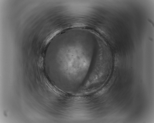 X0000099451401200805161011