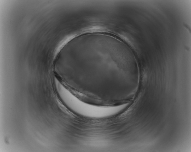 X0000099451413200805161011