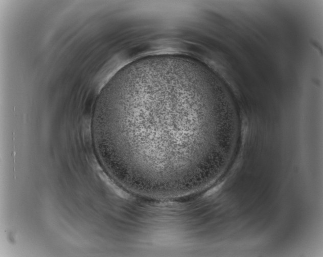 X0000099451417200805161011