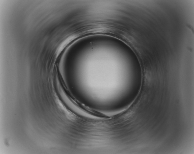X0000099451418200805161011
