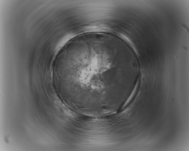 X0000099451419200805161011