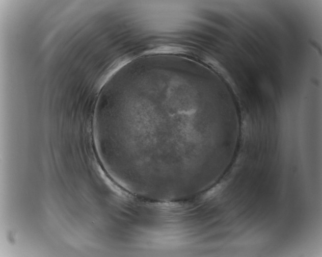 X0000099451425200805161011