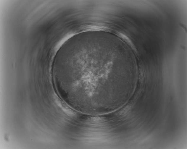 X0000099451427200805161011