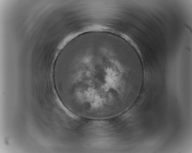 X0000099451429200805161011