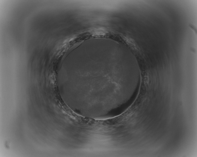 X0000099451445200805161011