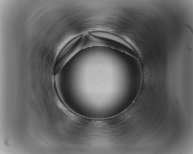 X0000099451476200805161010