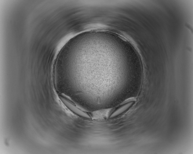 X0000099451488200805161010