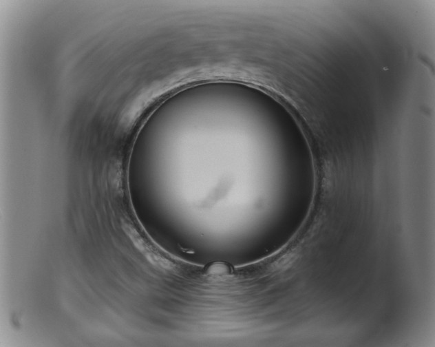 X0000099451499200805161010