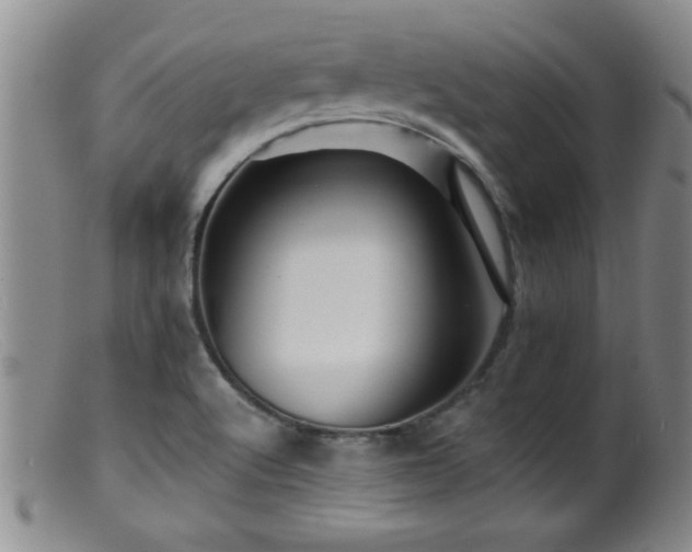 X0000099451512200805161010
