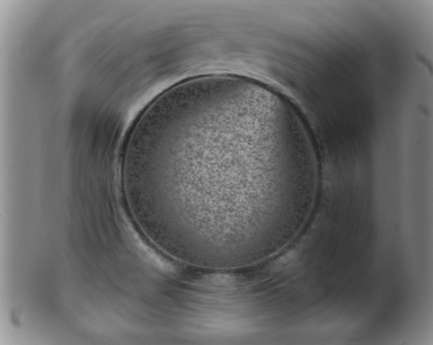 X0000099451517200805161010