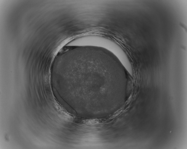 X0000099450100200805231752