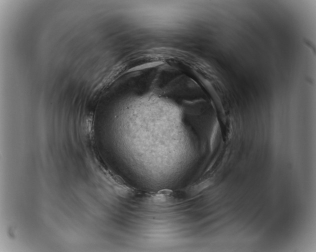 X0000099450382200805231747