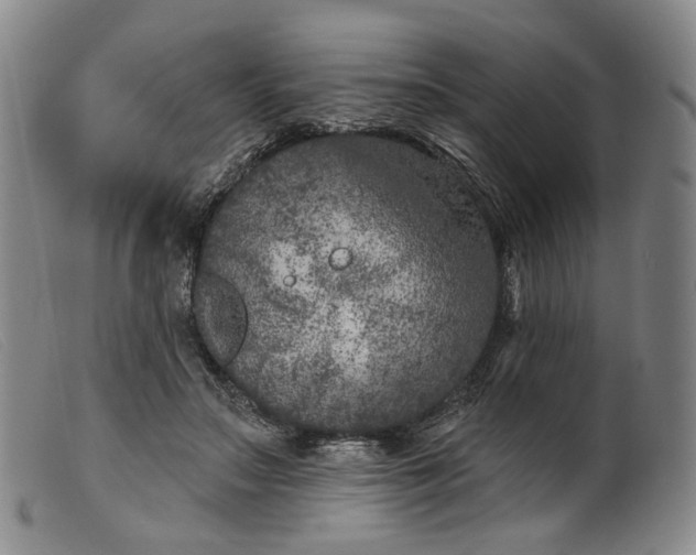 X0000099450499200805231745