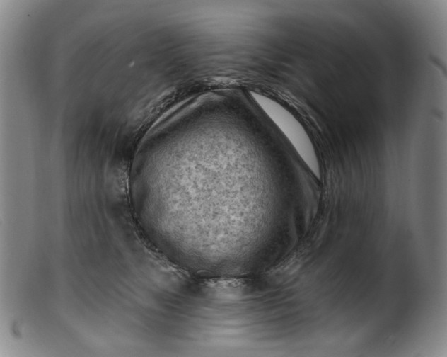 X0000099450517200805231744