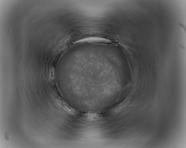 X0000099450528200805231744