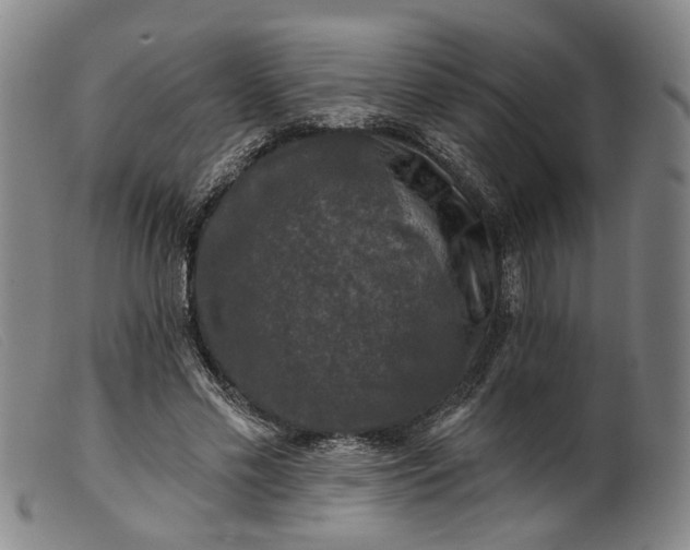 X0000099450589200805231743