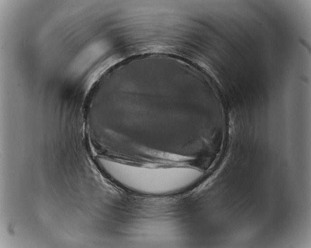 X0000099451117200805231735