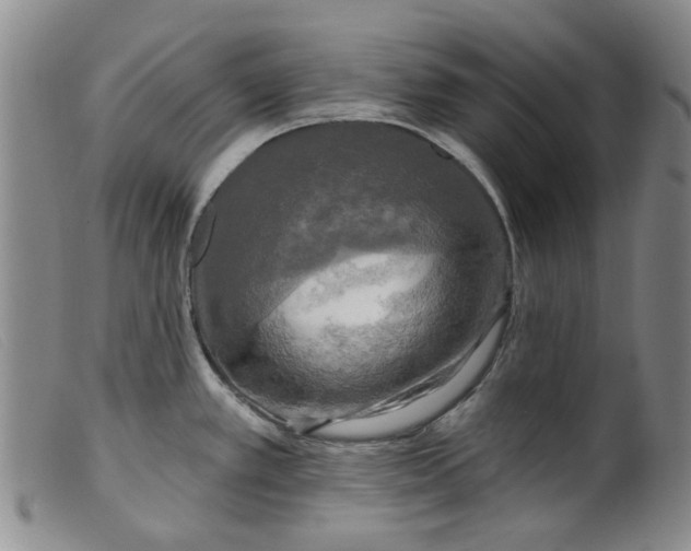 X0000099451389200805231731