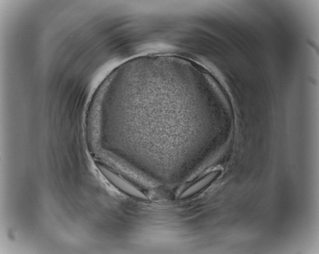 X0000099451488200805231729