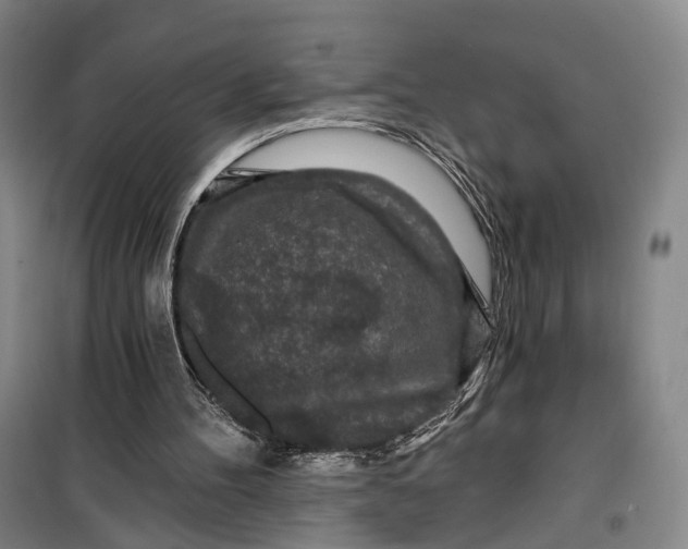 X0000099450100200805301521