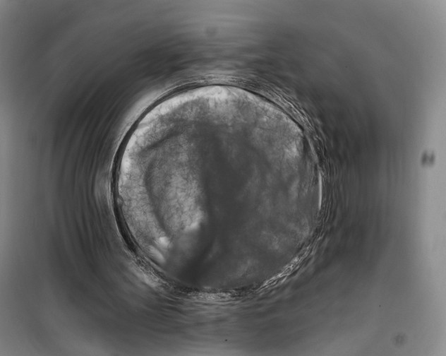 X0000099450147200805301520