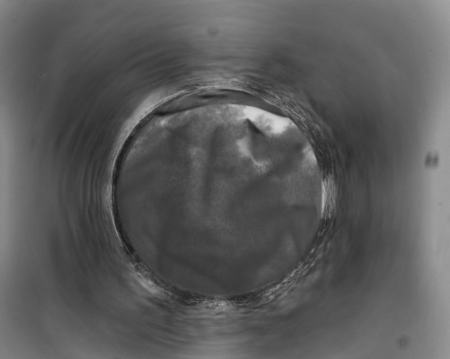 X0000099450195200805301520