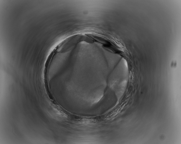 X0000099450292200805301519