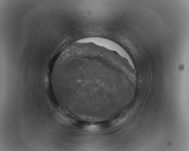 X0000099450312200805301518