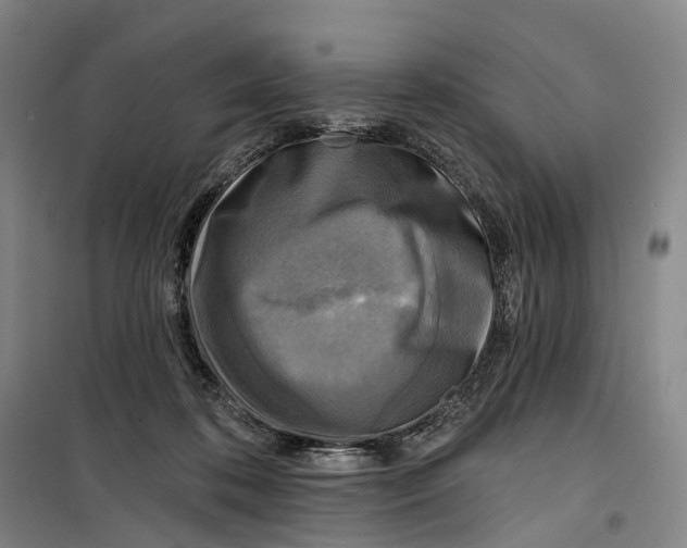 X0000099450316200805301518