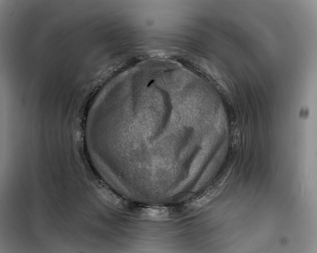 X0000099450317200805301518