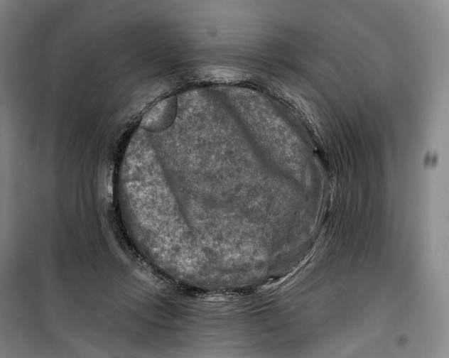 X0000099450358200805301518