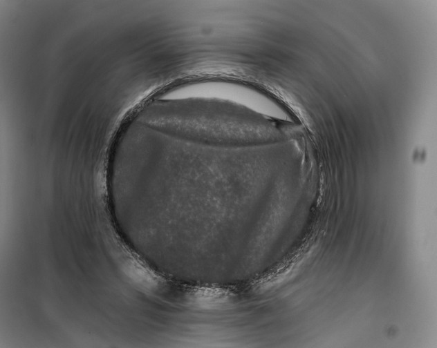 X0000099450399200805301517