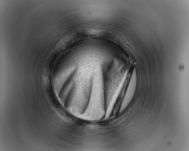 X0000099450408200805301517