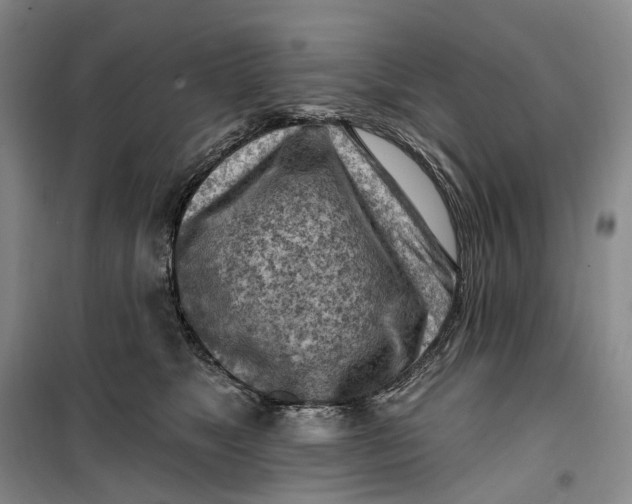 X0000099450517200805301515