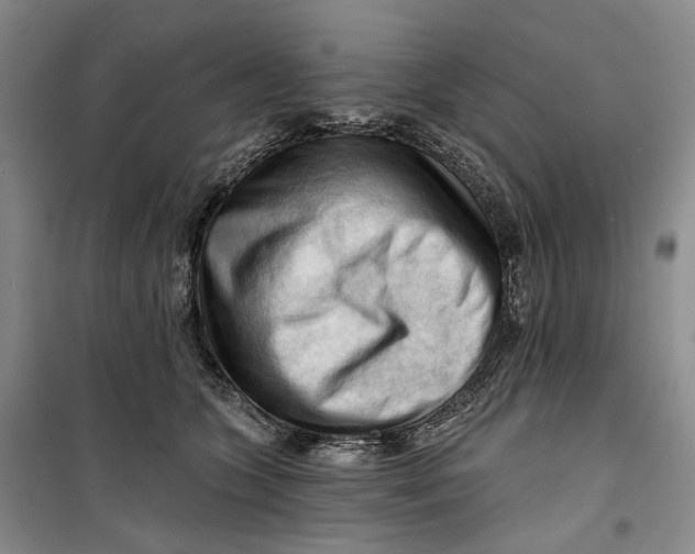 X0000099450563200805301515