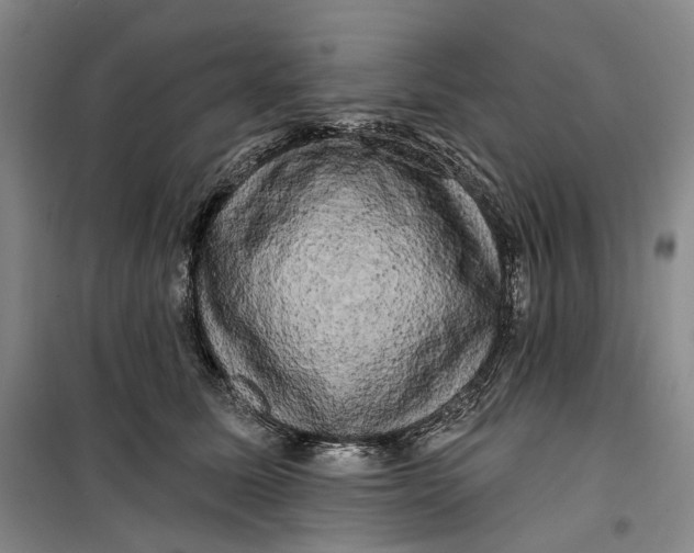 X0000099450611200805301514