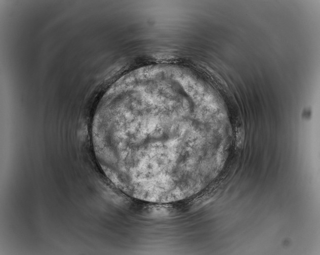 X0000099450618200805301514