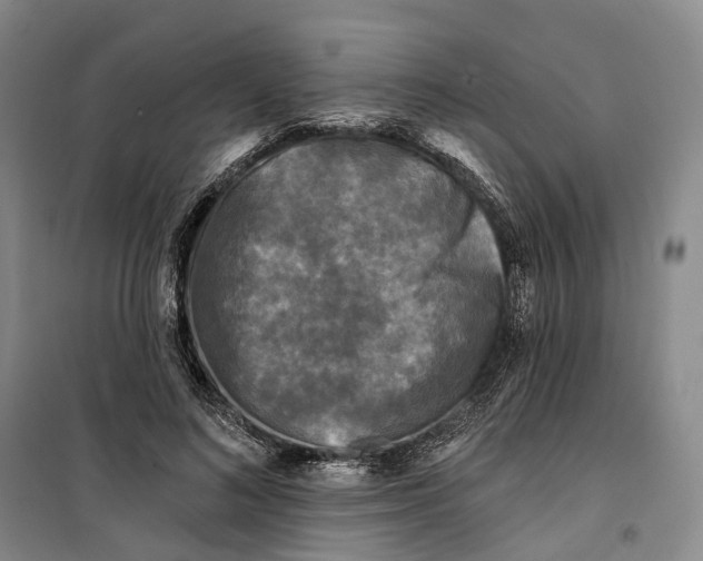 X0000099450692200805301513