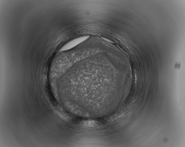 X0000099450695200805301513