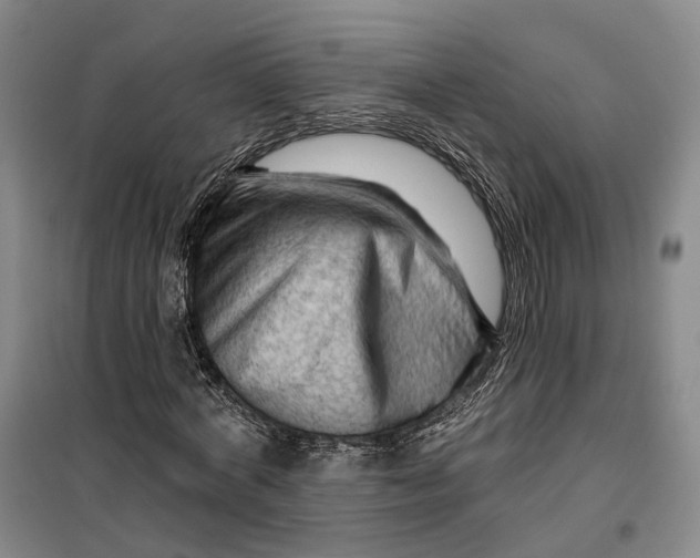 X0000099450772200805301512