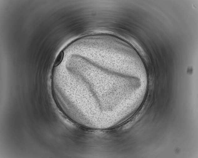 X0000099450814200805301511