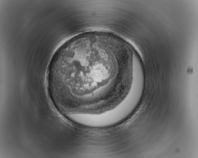 X0000099450983200805301509