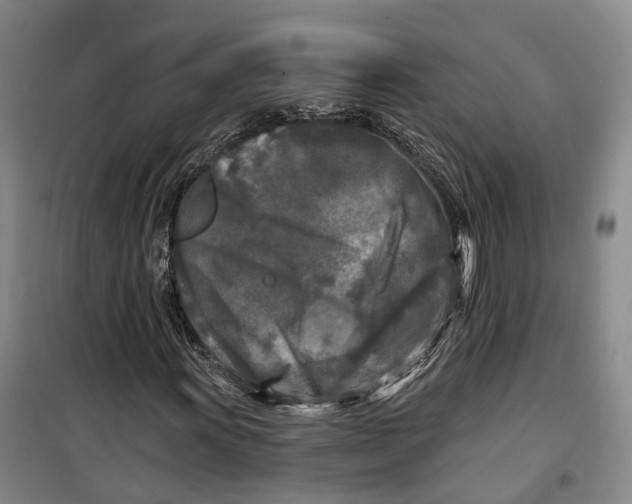 X0000099451011200805301507