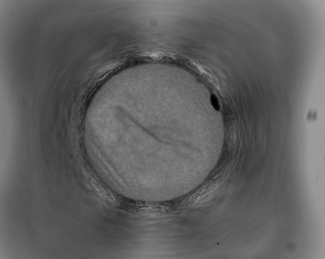 X0000099451105200805301506