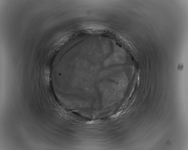 X0000099451108200805301506