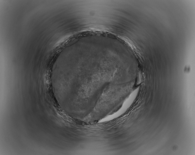 X0000099451110200805301506