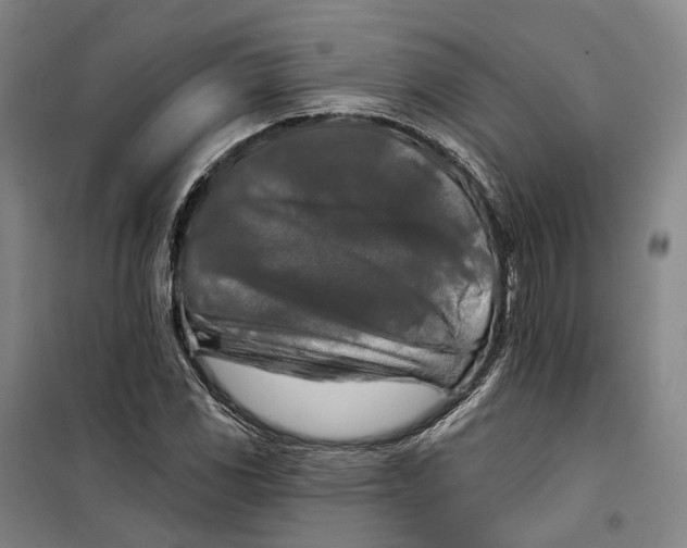 X0000099451117200805301506