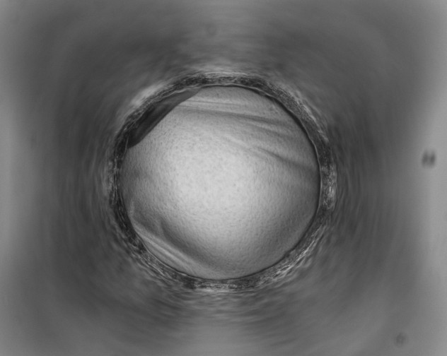 X0000099451157200805301506