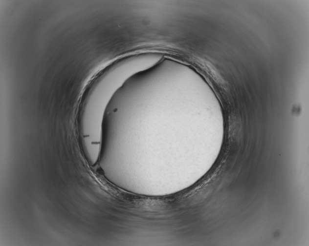 X0000099451164200805301506