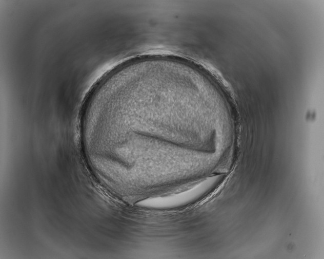 X0000099451167200805301506